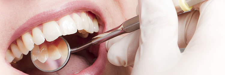 Parodontitisbehandlung-Besonderheit